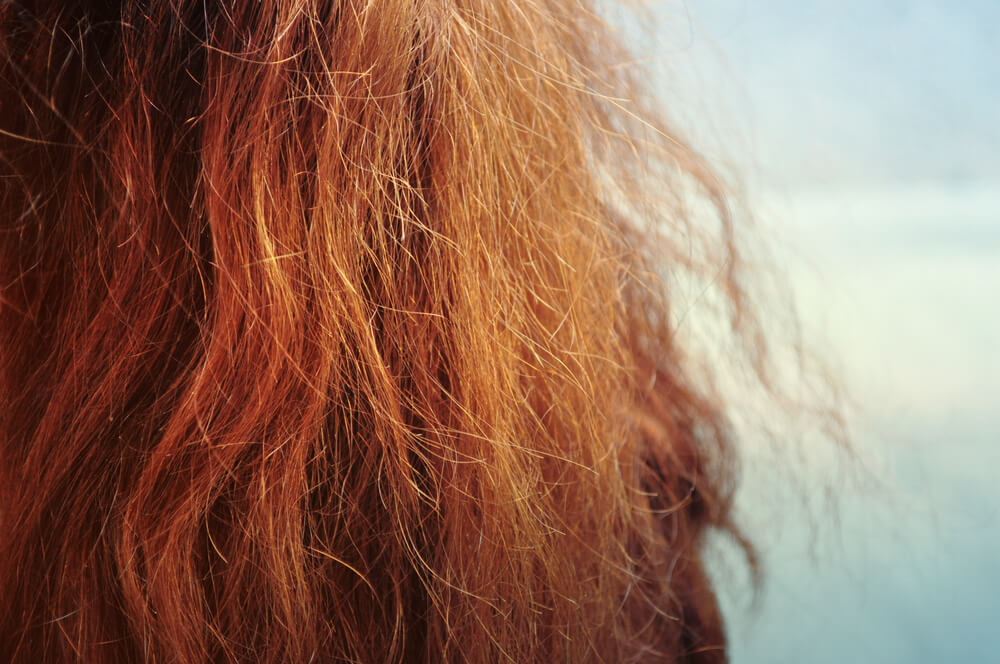 Dry Hair Causes Treatments and Diagnosis