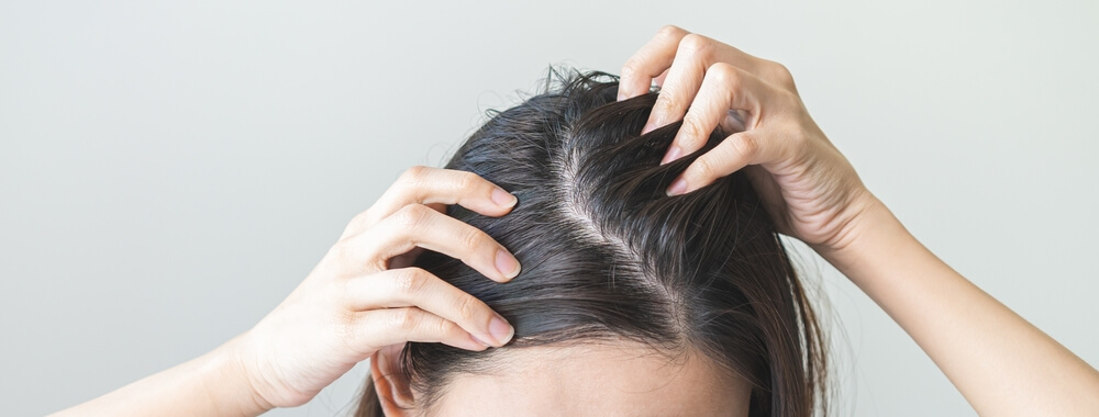 woman's scalp